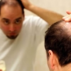 a natural cure for hair loss in men