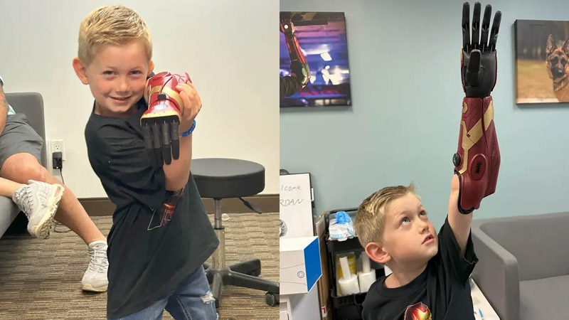  5-Year-Old Boy Born Without Left Hand Receives ‘Iron Man’ Arm & His Reaction Is Priceless